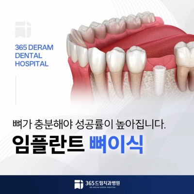 센텀 임플란트 썸네일_1.jpg